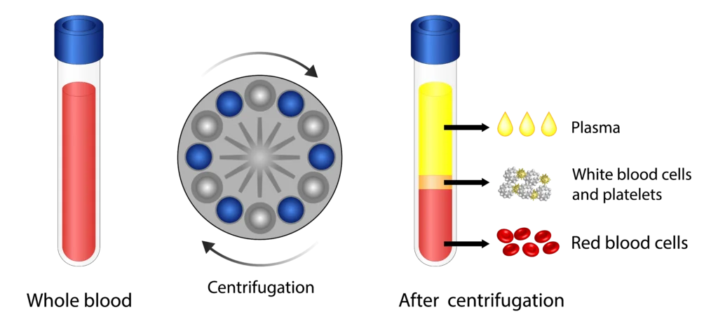 Diagram of the platelet-rich plasma (PRP) preparation process
