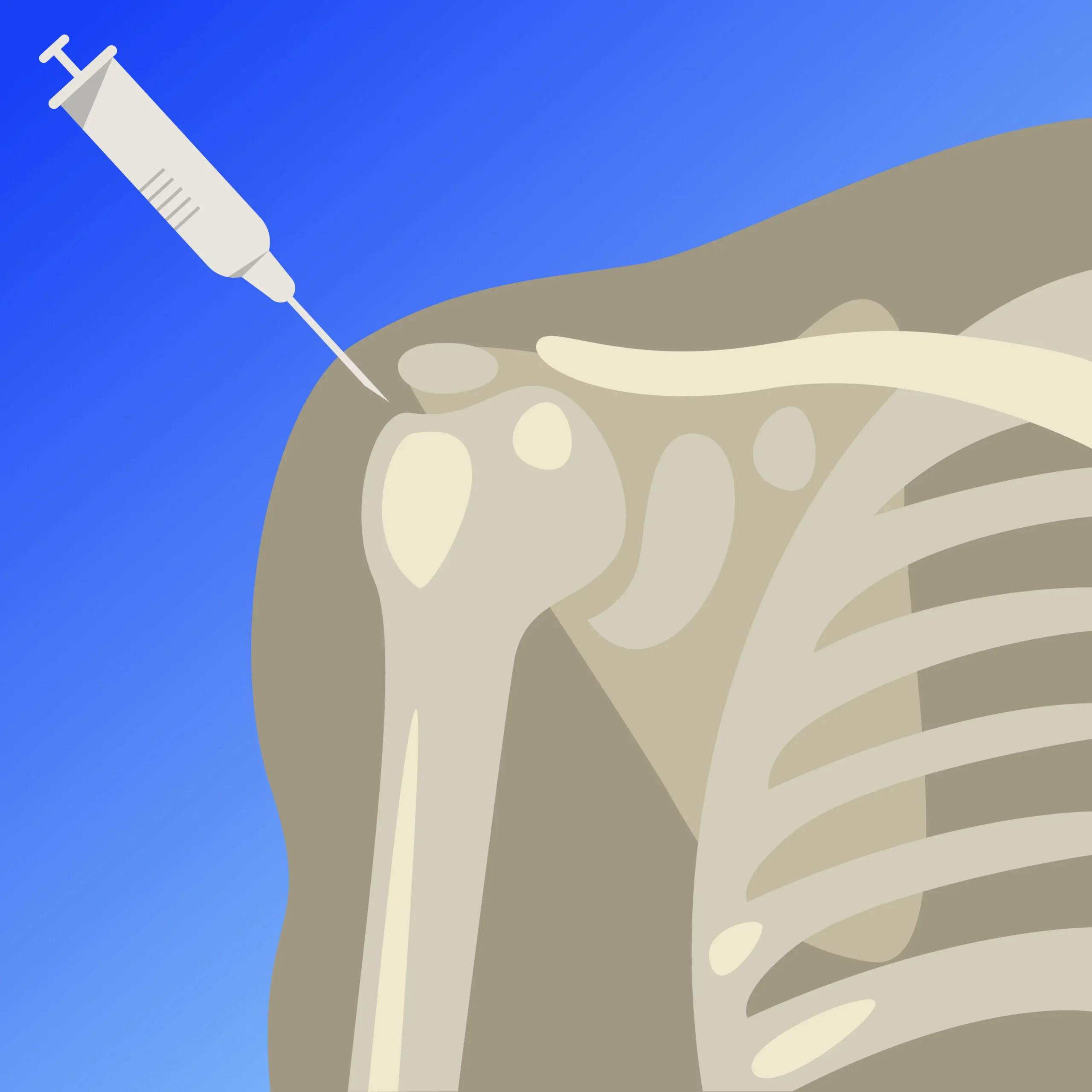 PRP for the Shoulder