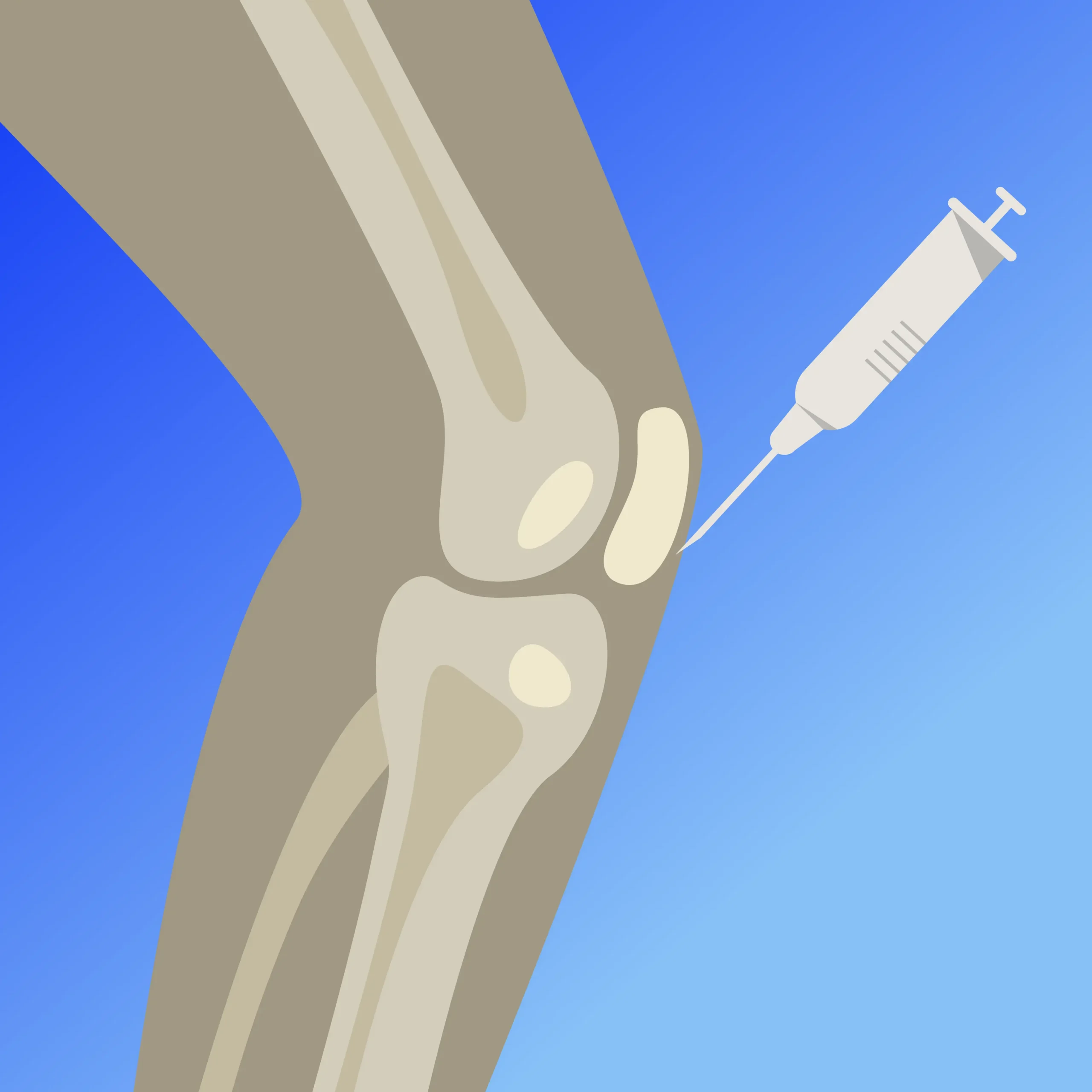 PRP for the Knee