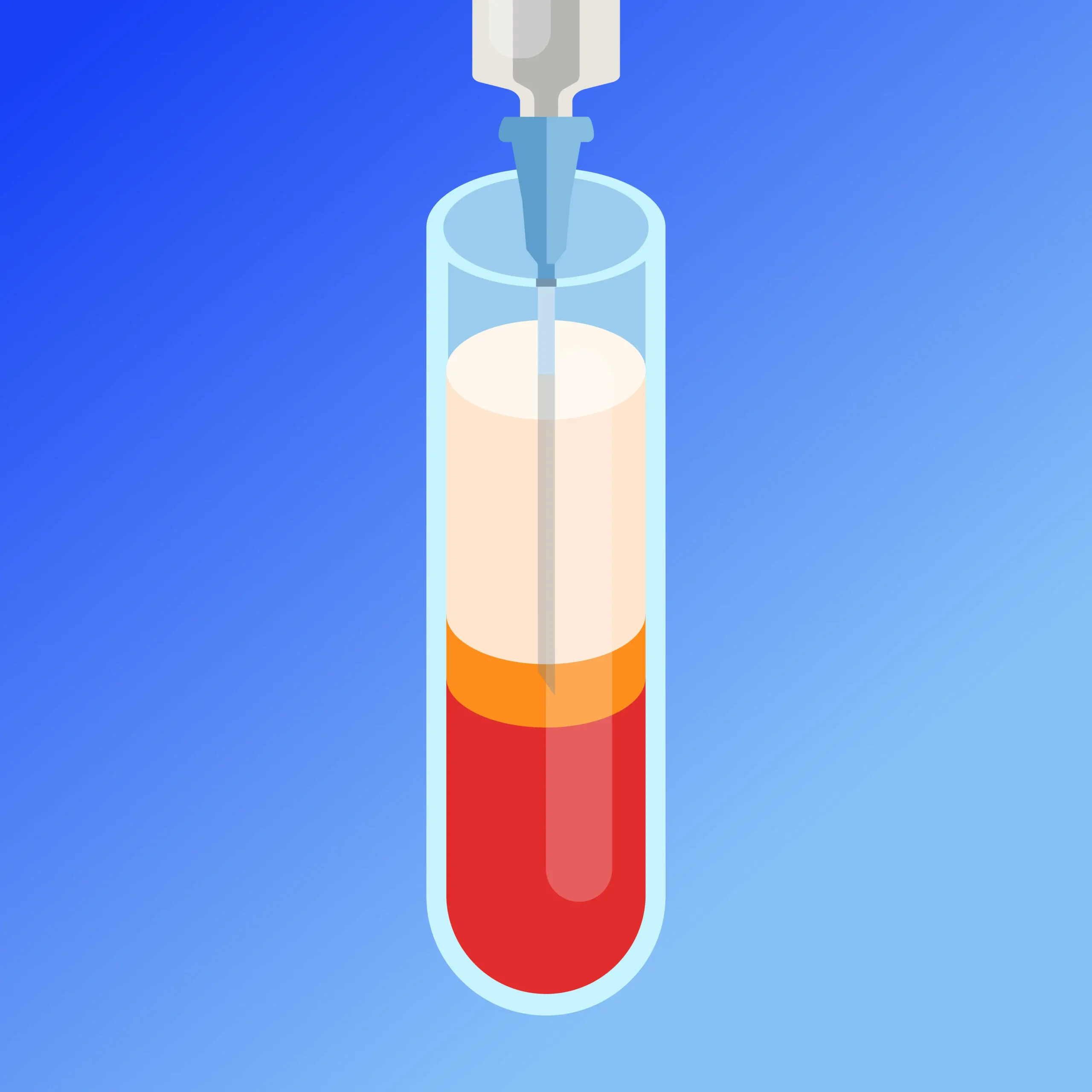 Platelet-Rich Plasma (PRP)